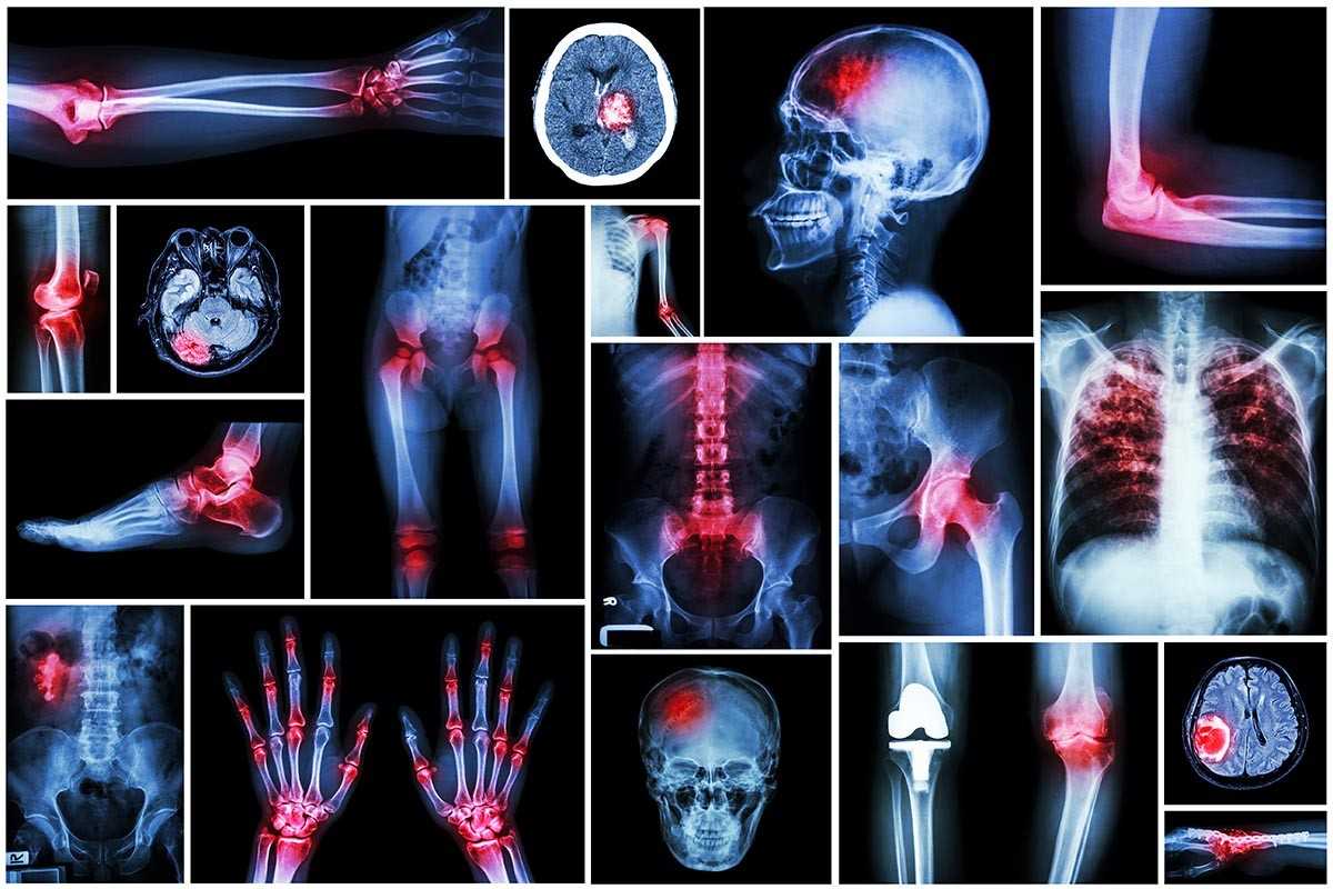 Collection x-ray multiple disease